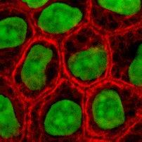 描述: http://upload.wikimedia.org/wikipedia/commons/7/7c/Epithelial-cells.jpg